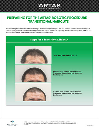 Transitional-Haircuts-Flyer Preparing for ARTAS Robotic Hair Transplant Procedure