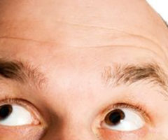 Busting Common Male Hair Loss Myths