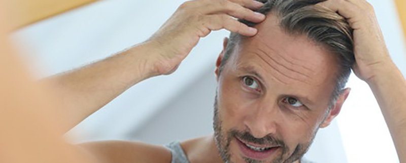 5 Signs You Might Only Have Temporary Hair Loss | Limmer HTC
