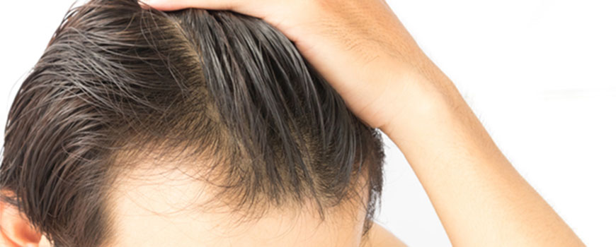What’s New? New Trends in Hair Transplants