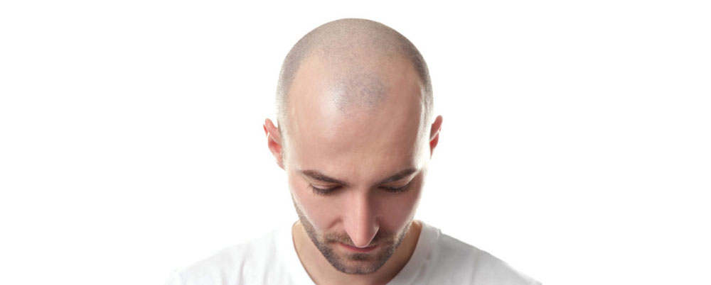 scalp zones male