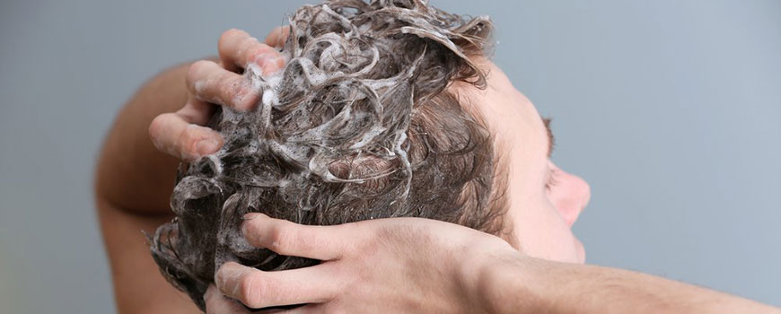 Does Head and Shoulders Cause Hair Loss?
