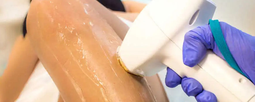 How Does Laser Hair Removal Work and is it Permanent? | Limmer HTC