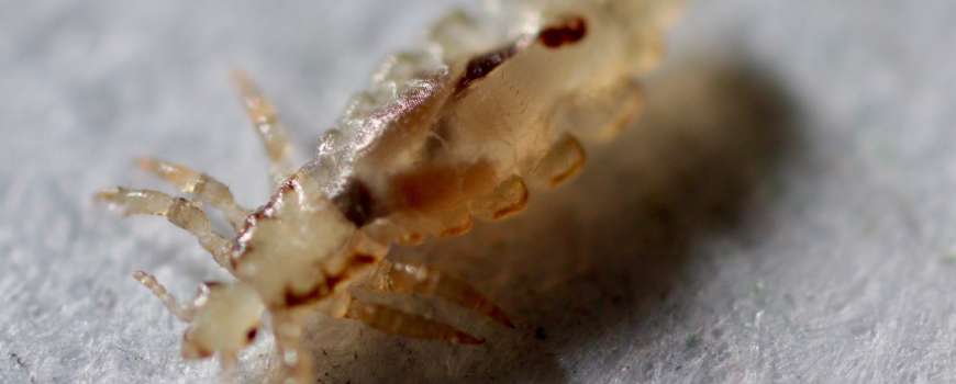 What’s the Difference Between Fleas and Lice? Can Fleas Live in Human Hair?